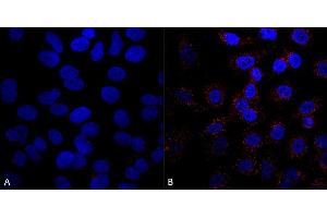 Immunocytochemistry/Immunofluorescence analysis using Mouse Anti-VPS35 Monoclonal Antibody, Clone 5A9 (ABIN6932953). (VPS35 抗体  (PerCP))