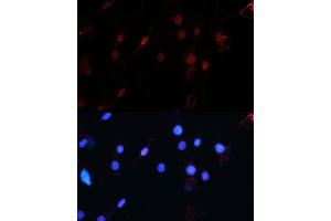 Immunofluorescence analysis of C6 using ZEB1 antibody (ABIN6129933, ABIN6150422, ABIN6150423 and ABIN6221237) at dilution of 1:100 (40x lens). (ZEB1 抗体  (AA 1-260))