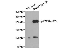 Western Blotting (WB) image for anti-Epidermal Growth Factor Receptor (EGFR) (pTyr869) antibody (ABIN1870109) (EGFR 抗体  (pTyr869))