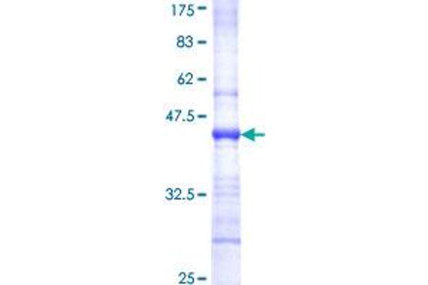 ABHD5 Protein (AA 240-342) (GST tag)