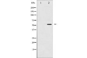 Western blot analysis of PPAR- gamma phosphorylation expression in Paclitaxel treated Jurkat whole cell lysates,The lane on the left is treated with the antigen-specific peptide. (PPARG 抗体  (pSer112))