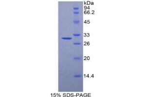 SDS-PAGE analysis of Pig alpha 2-Macroglobulin Protein. (alpha 2 Macroglobulin 蛋白)