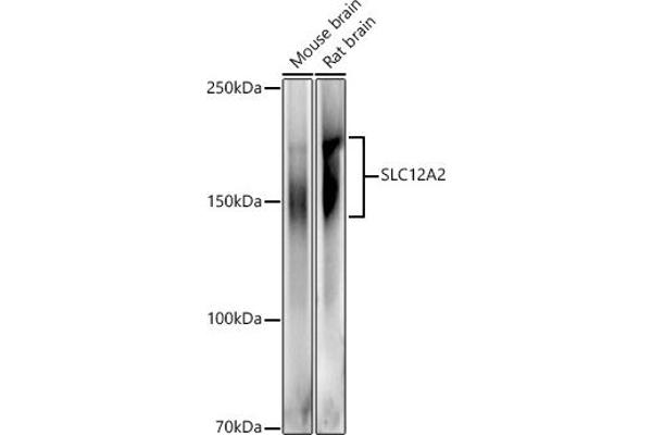 SLC12A2 抗体  (AA 120-280)