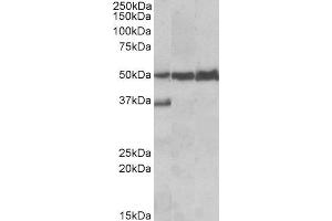 ABIN2563723 (0. (LSP1 抗体  (C-Term))