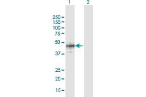 Western Blot analysis of B3GAT1 expression in transfected 293T cell line by B3GAT1 MaxPab polyclonal antibody. (CD57 抗体  (AA 1-334))