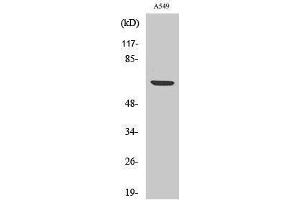 Western Blotting (WB) image for anti-Ribosomal Protein S6 Kinase, 70kDa, Polypeptide 1 (RPS6KB1) (pSer447) antibody (ABIN3182113) (RPS6KB1 抗体  (pSer447))