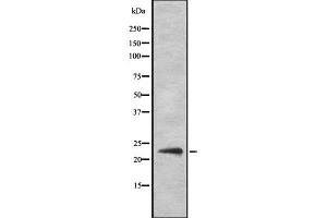 Western blot analysis of SOCS2 Antibody expression in Hela cells lysates. (SOCS2 抗体)