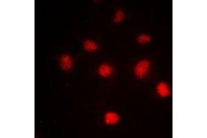 Immunofluorescent analysis of Histone H4 (AcK5) staining in HeLa cells. (Histone H4 抗体  (acLys5, N-Term))