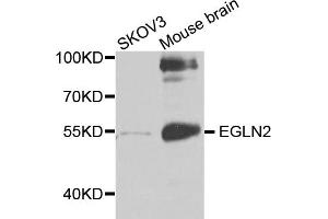 Western blot analysis of extracts of various cell lines, using EGLN2 antibody (ABIN1872459) at 1:1000 dilution. (PHD1 抗体)