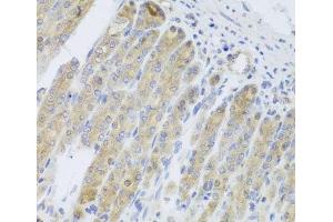 Immunohistochemistry of paraffin-embedded Mouse stomach using RARS2 Polyclonal Antibody at dilution of 1:100 (40x lens). (RARS2 抗体)