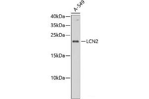 Western blot analysis of extracts of A-549 cells using LCN2 Polyclonal Antibody at dilution of 1:1000. (Lipocalin 2 抗体)