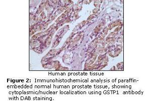 Image no. 1 for anti-Glutathione S-Transferase pi 1 (GSTP1) antibody (ABIN207627) (GSTP1 抗体)