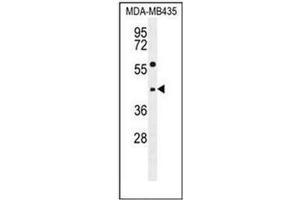 Western blot analysis of ABHD9 Antibody (C-term) in MDA-MB435 cell line lysates (35ug/lane). (ABHD9 抗体  (C-Term))