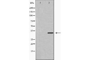 Western blot analysis of Fra 2 expression in LOVO cell extract. (FOSL2 抗体  (C-Term))