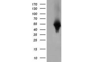 HEK293T cells were transfected with the pCMV6-ENTRY control (Left lane) or pCMV6-ENTRY HP (Right lane) cDNA for 48 hrs and lysed. (Haptoglobin 抗体)