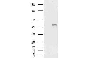 HEK293 overexpressing ALDH1A1 and probed with ABIN2561029 (mock transfection in first lane). (ALDH1A1 抗体  (Internal Region))