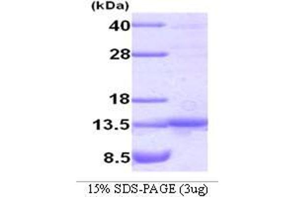 TANK Protein (AA 1-119)