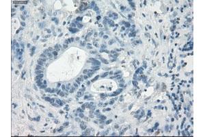 Immunohistochemistry (IHC) image for anti-Leukotriene A4 Hydrolase (LTA4H) antibody (ABIN1499214) (LTA4H 抗体)