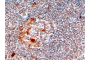 Immunohistochemistry (IHC) image for anti-Zinc Finger, CCHC Domain Containing 11 (ZCCHC11) (C-Term) antibody (ABIN2466463) (ZCCHC11 抗体  (C-Term))