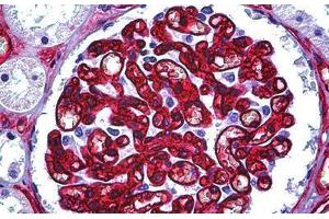 Human Kidney, Glomerulus: Formalin-Fixed, Paraffin-Embedded (FFPE) (CD34 抗体)