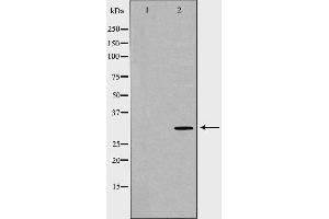 Western blot analysis of extracts of jurkat using CASP3 antibody. (Caspase 3 抗体  (N-Term))