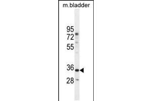 Western blot analysis in mouse bladder tissue lysates (35ug/lane). (C17orf59 抗体  (AA 186-215))
