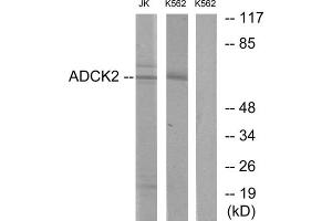 Western blot analysis of extracts from Jurkat cells and K562 cells, using ADCK2 antibody. (ADCK2 抗体  (Internal Region))
