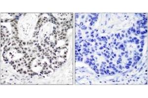 Immunohistochemistry (IHC) image for anti-Androgen Receptor (AR) (pSer650) antibody (ABIN2888357) (Androgen Receptor 抗体  (pSer650))