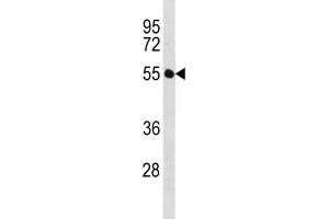 Western Blotting (WB) image for anti-Immunoglobin Superfamily, Member 21 (IGSF21) antibody (ABIN3004517) (IGSF21 抗体)