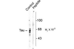 Image no. 1 for anti-Microtubule-Associated Protein tau (MAPT) (pSer416) antibody (ABIN303964) (MAPT 抗体  (pSer416))