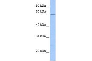 WB Suggested Anti-ZKSCAN4 Antibody Titration:  0. (ZKSCAN4 抗体  (N-Term))