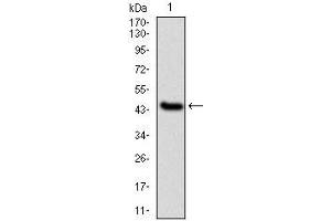 Western blot analysis using IL1B mAb against human IL1B (AA: 126-261) recombinant protein. (IL-1 beta 抗体)