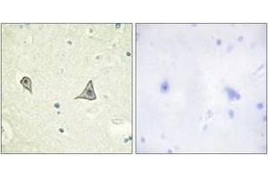 Immunohistochemistry (IHC) image for anti-Colony Stimulating Factor 1 Receptor (CSF1R) (AA 691-740) antibody (ABIN2888738) (CSF1R 抗体  (AA 691-740))