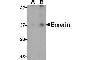 Western blot analysis of Emerin in human skeletal muscle tissue lysate with Emerin antibody at (A) 0. (Emerin 抗体  (N-Term))