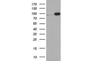 Western Blotting (WB) image for anti-Catenin (Cadherin-Associated Protein), beta 1, 88kDa (CTNNB1) antibody (ABIN1496896) (CTNNB1 抗体)