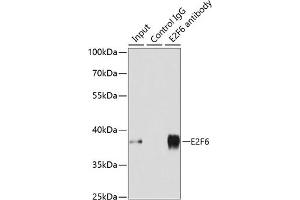 Immunoprecipitation analysis of 200 μg extracts of MCF-7 cells using 3 μg E2F6 antibody (ABIN1679632, ABIN1679631, ABIN5664137 and ABIN6219769). (E2F6 抗体  (AA 1-281))