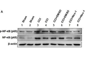 Western Blotting (WB) image for anti-Nuclear Factor-kB p65 (NFkBP65) (pSer536) antibody (ABIN730528)