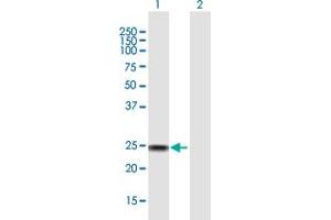 Western Blot analysis of SSX4 expression in transfected 293T cell line by SSX4 MaxPab polyclonal antibody. (SSX4 抗体  (AA 1-188))