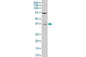 CD68 polyclonal antibody (A01), Lot # 060717JCS1. (CD68 抗体  (AA 164-262))