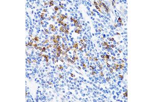 Immunohistochemistry of paraffin-embedded human tonsil using TNFSF12 Antibody (ABIN1876860) at dilution of 1:100 (40x lens). (TWEAK 抗体)