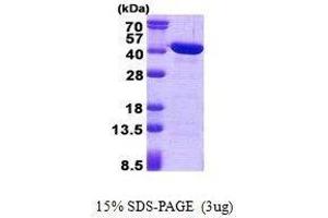 Figure annotation denotes ug of protein loaded and % gel used. (CAB39L 蛋白)