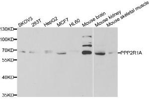 Western blot analysis of extracts of various cell lines, using PPP2R1A antibody (ABIN5973416) at 1/1000 dilution. (PPP2R1A 抗体)