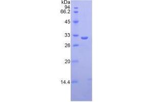 SDS-PAGE analysis of Human Ficolin 3 Protein. (FCN3 蛋白)