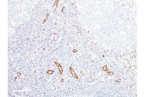 Image no. 1 for anti-Vascular Endothelial Growth Factor A (VEGFA) antibody (ABIN6168158) (VEGFA 抗体)