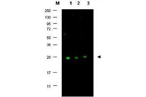 Image no. 1 for anti-P27 antibody (ABIN636752) (P27 抗体)