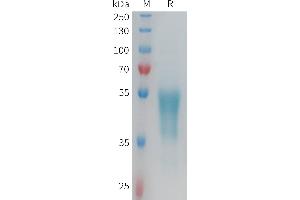 G Protein-Coupled Receptor 132 Protein (GPR132) (AA 1-45) (Fc Tag)