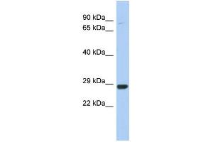 WB Suggested Anti-C21orf91 Antibody Titration:  0. (C21orf91 抗体  (Middle Region))