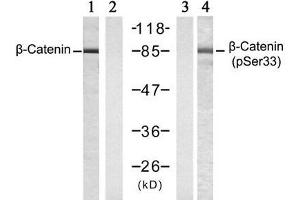 Western blot analysis of extracts from SW 626 cells , untreated or treated with Calyculin A (50nM, 30min), using β-Catenin (Ab-33) antibody (E021211, Lane 1 and 2) and β-Catenin (phospho-Ser33) antibody (E011218, Lane 3 and 4). (beta Catenin 抗体)
