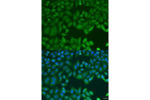 Immunofluorescence analysis of U2OS cells using MAP2K3 antibody (ABIN2737130) at dilution of 1:100. (MAP2K3 抗体)