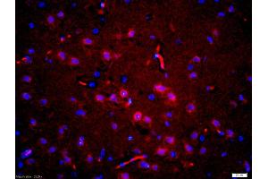 Formalin-fixed and paraffin embedded rat brain labeled with Anti-phospho-Tau protein(Thr181)Polyclonal Antibody, Unconjugated (ABIN1387422) at 1:200 followed by conjugation to the secondary antibody Goat Anti-Rabbit IgG, Cy3 conjugated used at 1:200 dilution for 40 minutes at 37 °C and DAPI staining (tau 抗体  (pThr181))